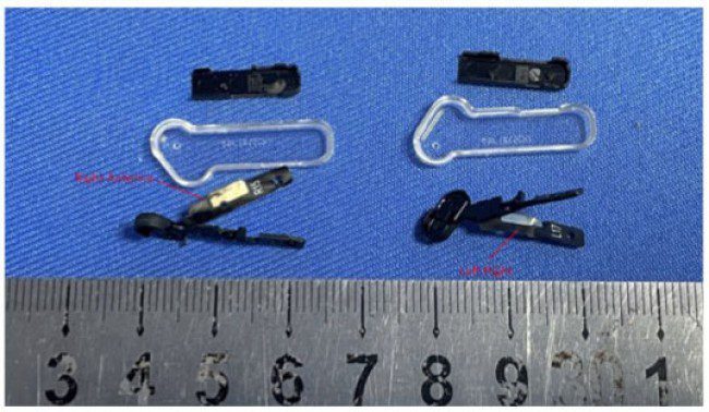 Nothing Ear (Stick) earbuds casing and antennas